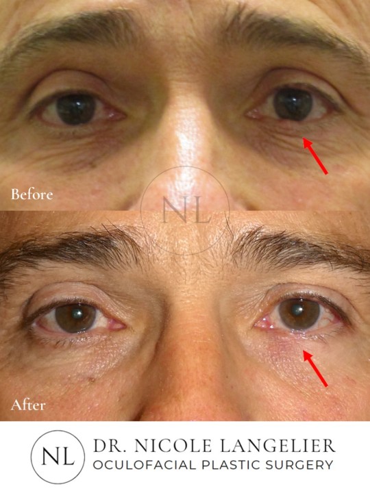 Skin Cancer Reconstruction