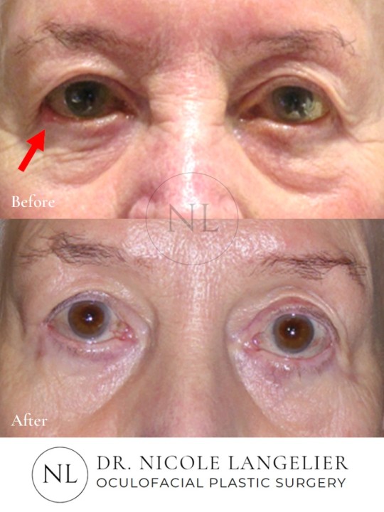 Skin Cancer Reconstruction