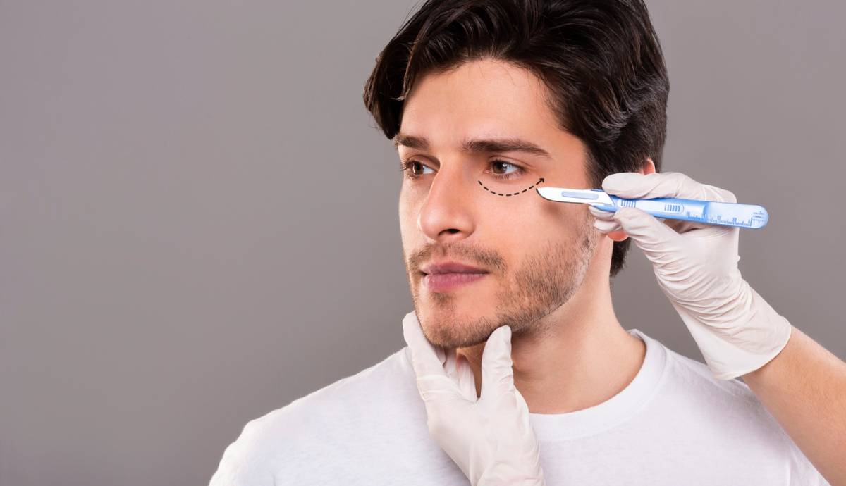 Featured image for How to Qualify for Eyelid Surgery