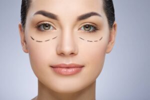 Secondary Image for What Should You Do (and Avoid) to Prepare for Eyelid Surgery